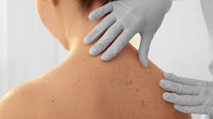 Vorlesung von Frau Univ.-Doz. Univ. FÄ Dr.med.univ. Wolf zum Thema Hauttumore und Transplantation