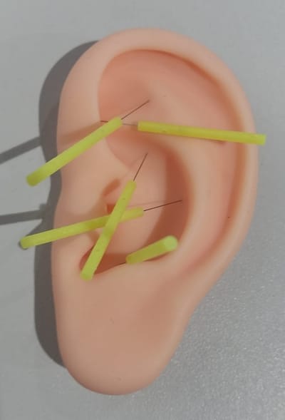 Behandeltechnieken image