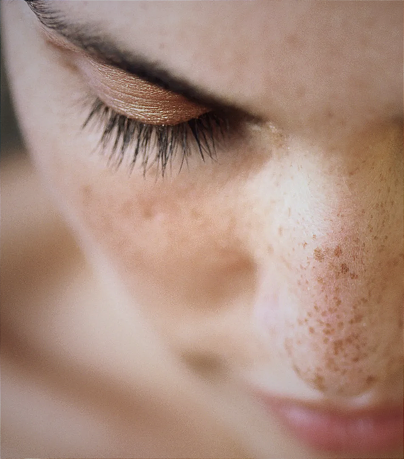 FAUX FRECKLES