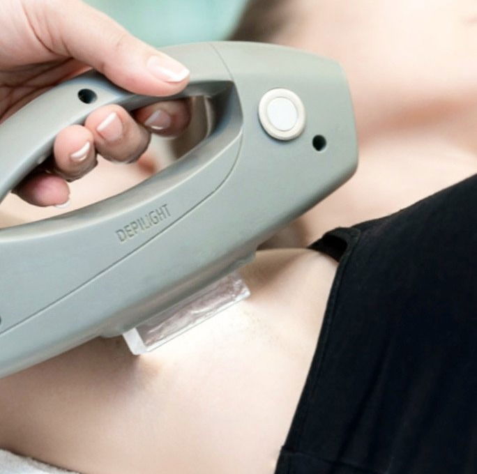 Haarentfernung mit Depilight (IPL)