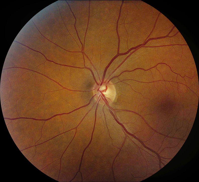 Retinal Imaging (Additional) $29