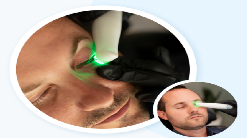 In-Office Dry Eye/Blepharitis Treatment $79 / $49 (with same day D/C)