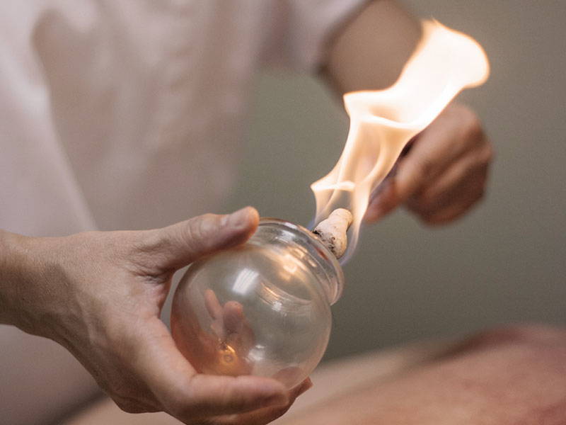 Fire Cupping