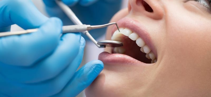 CONSERVATIVE DENTAL TREATMENT