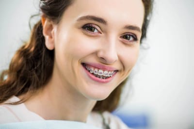 Can You Get Braces At Bottom Teeth?