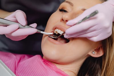 How To Make Your Braces Journey Fun With Colorful Colors?