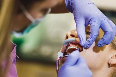 What Types of Orthodontic Headgear are Commonly Used?