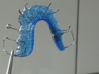 How Long Should A Person Wear A Hawley Retainer Each Day?
