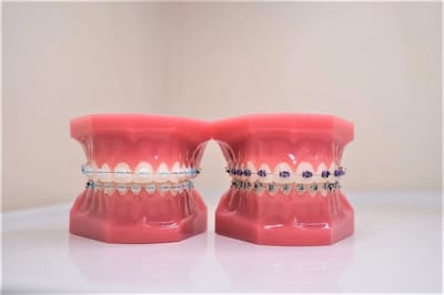 Advantages of Choosing MetLife Dentists for Invisalign in North Miami