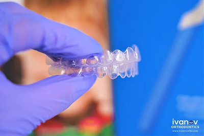 Are Rubber Band Braces the Best Choice for Your Dental Needs?