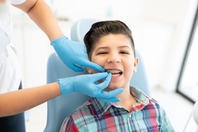 The Advantage of Invisalign: Is It the Best Alternative to Braces?