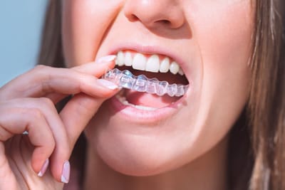 What Are the Benefits of Invisalign for Kids from an Orthodontist in North Miami?