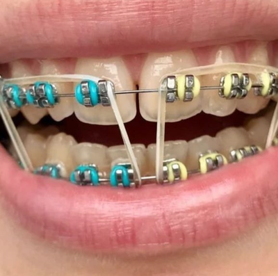 {{trans:600a5361ce87aecedda4659325581ac4_1}} image