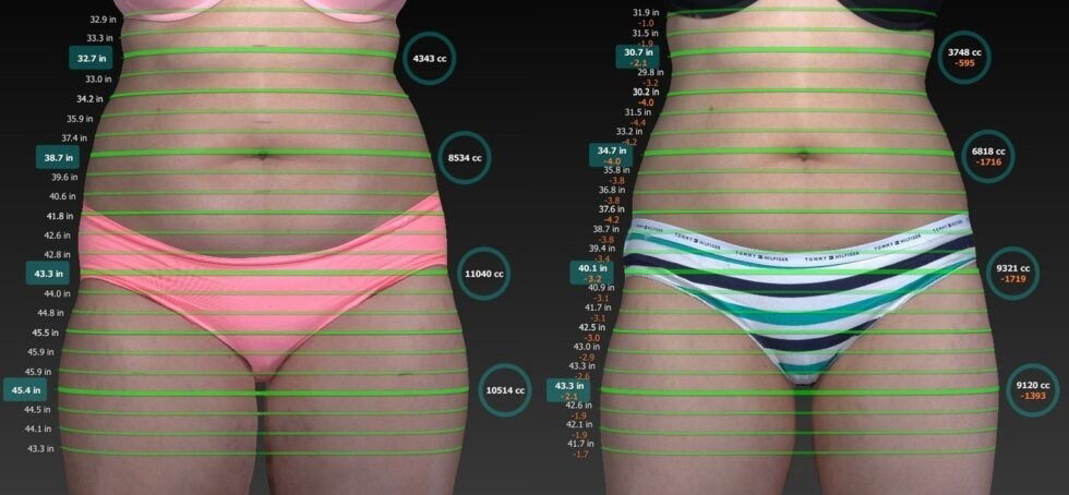 Precise 3D imaging