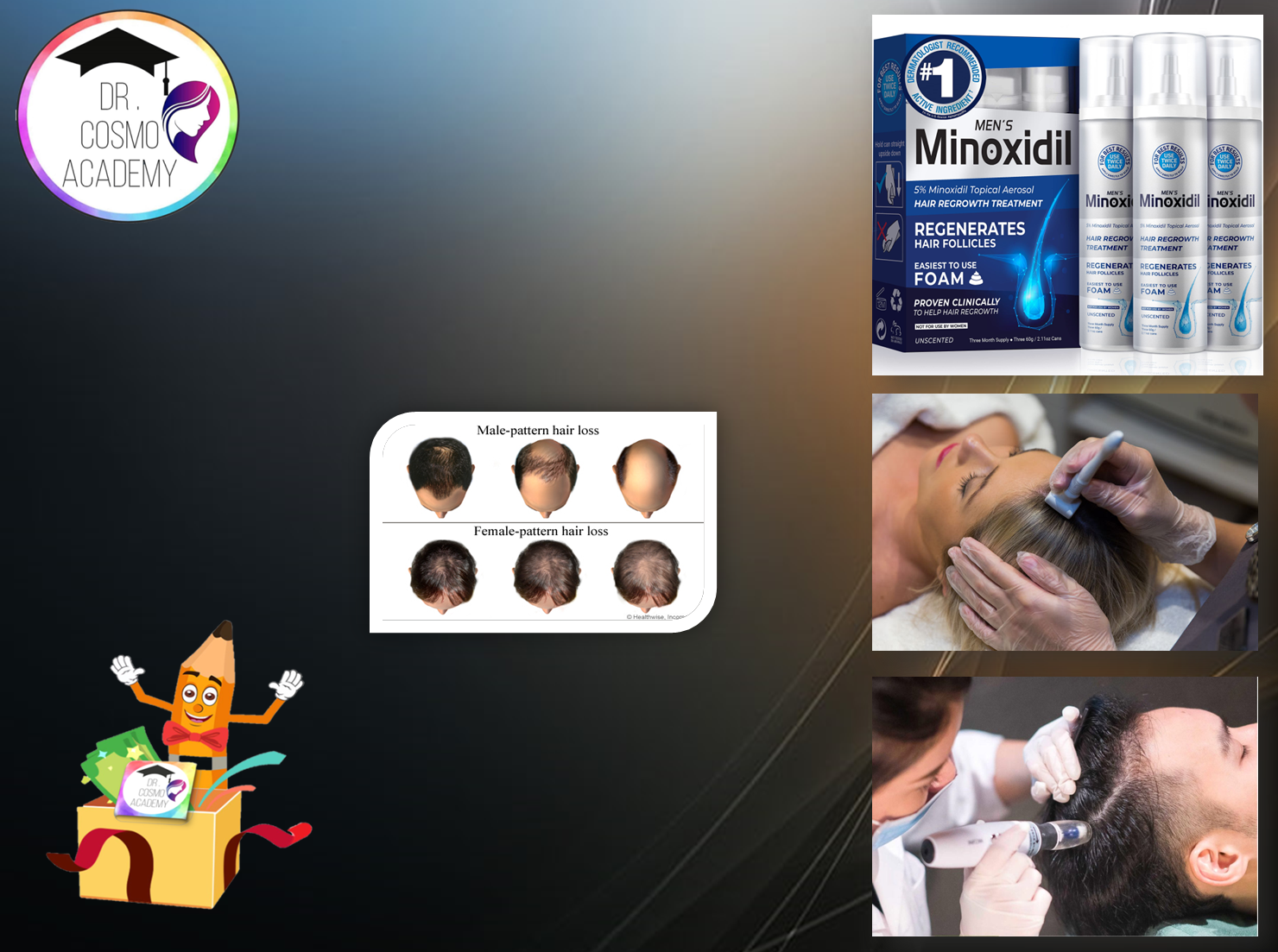 استخدام تقنية ال                                    (Micro-needling مع Minoxidil)                                                                            في تساقط الشعر الوراثي ....(منقول بتفحص)