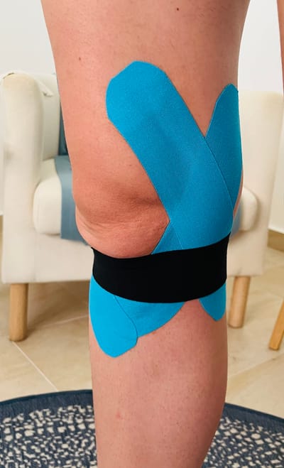Kinesiotape terápia image