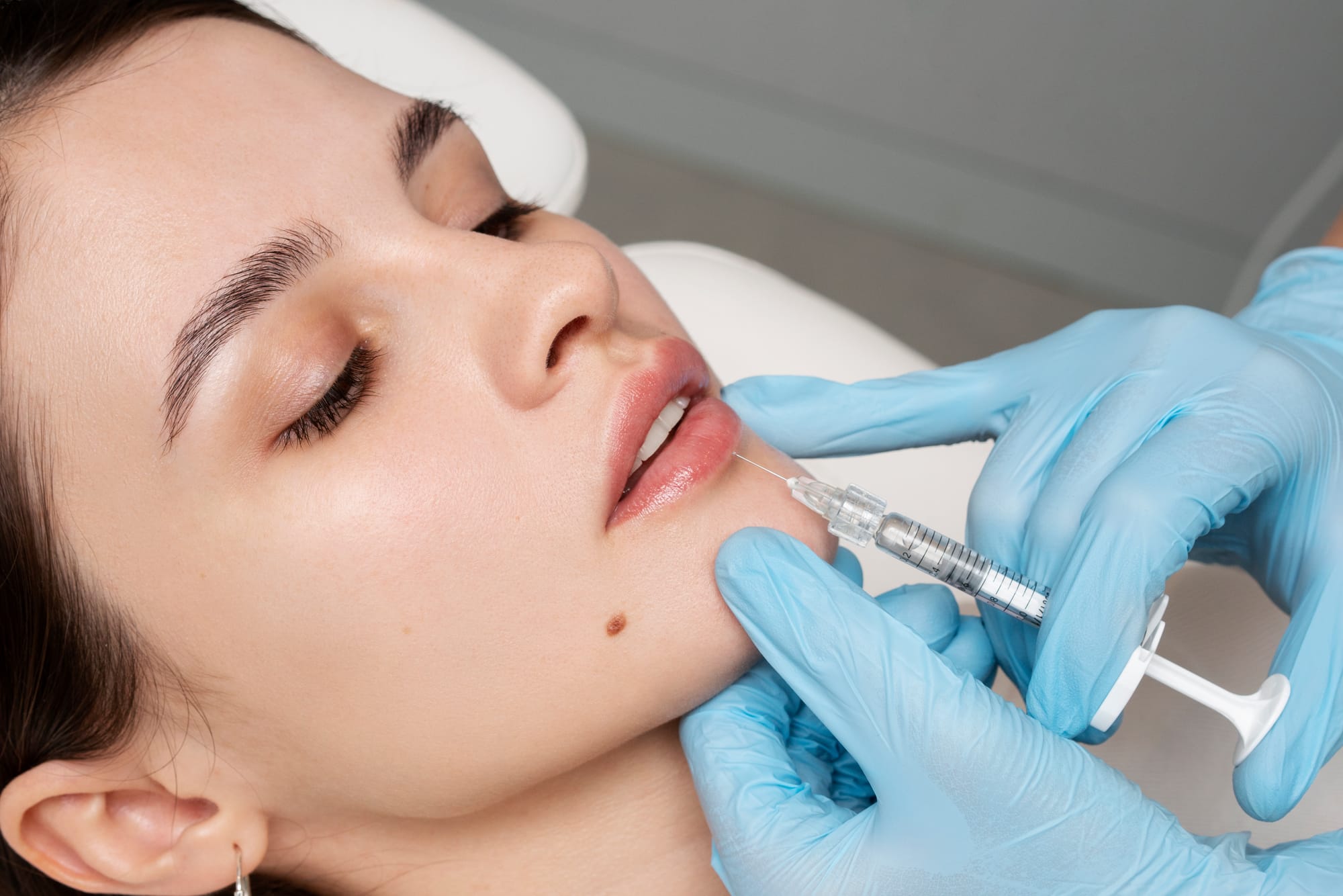 4 Reasons Lip Fillers are Great