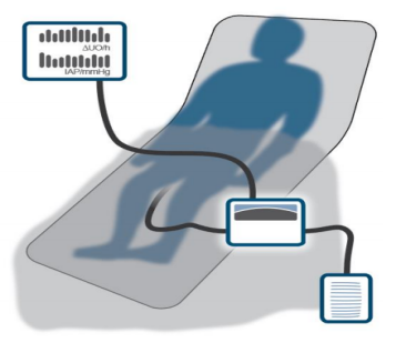 Sentinal for ICU patients