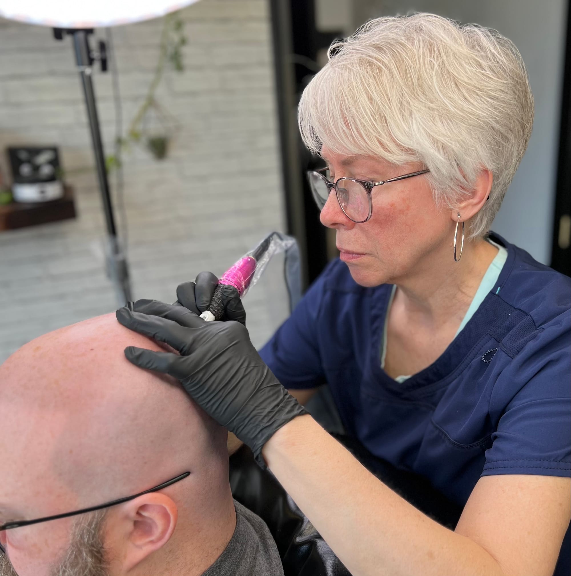 Scalp micropigmentation for the 5 oclock shadow