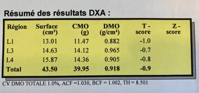 Comment interpréter les résultats de l’ostéodensitométrie  ? image
