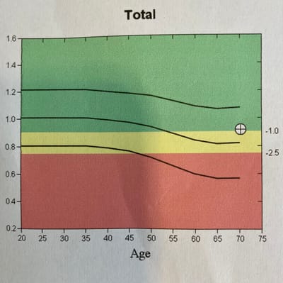Comment interpréter les résultats de l’ostéodensitométrie  ? image