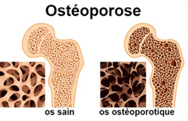 Quelles sont les causes image