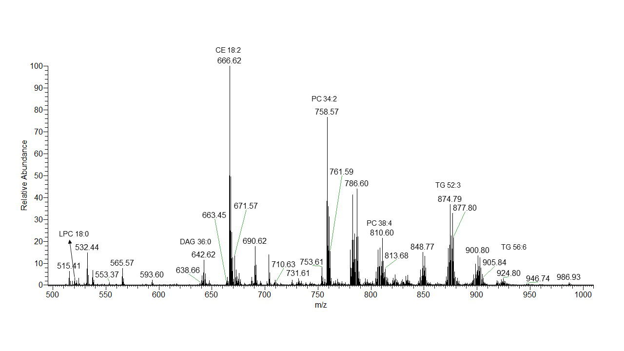 Lysosomal Lipid Metabolism and Neurodegeneration