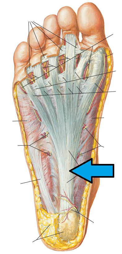 Do You Think You Have Plantar Fasciitis?