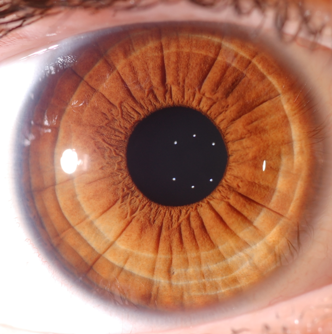 iridologia psicosomatica