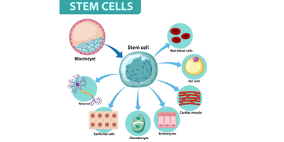 Affordable and Advanced Stem Cell Transplants in India