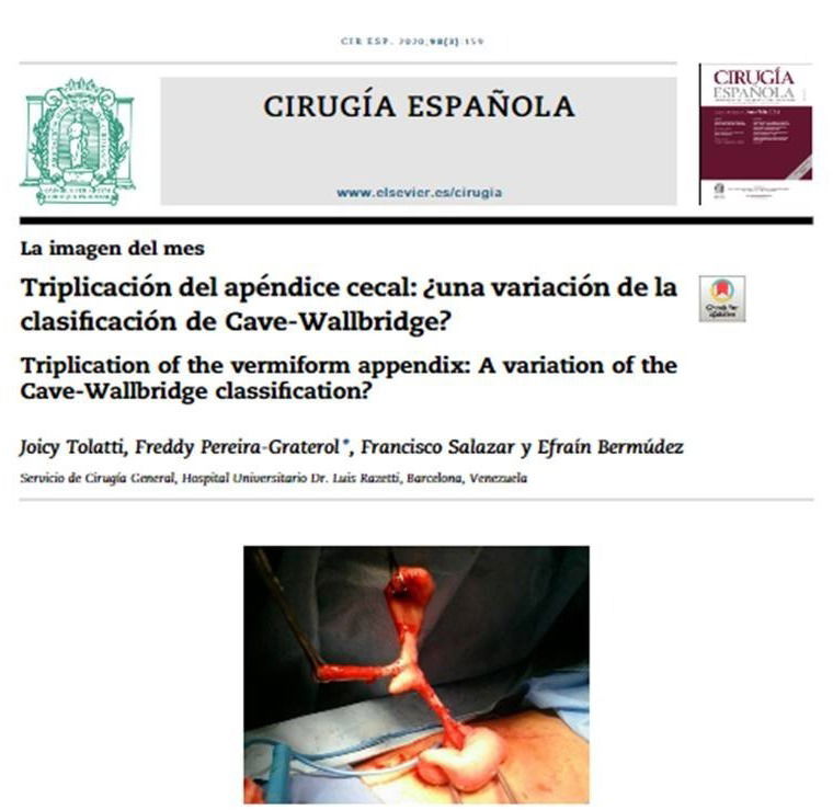 TRIPLICACIÓN APENDICULAR: A propósito de un caso.