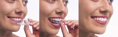 How to Find A Professional Orthodontist Near You