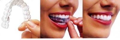 How to Find an Orthodontist