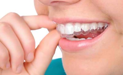 The Secrets Of Hiring The Best Orthodontist