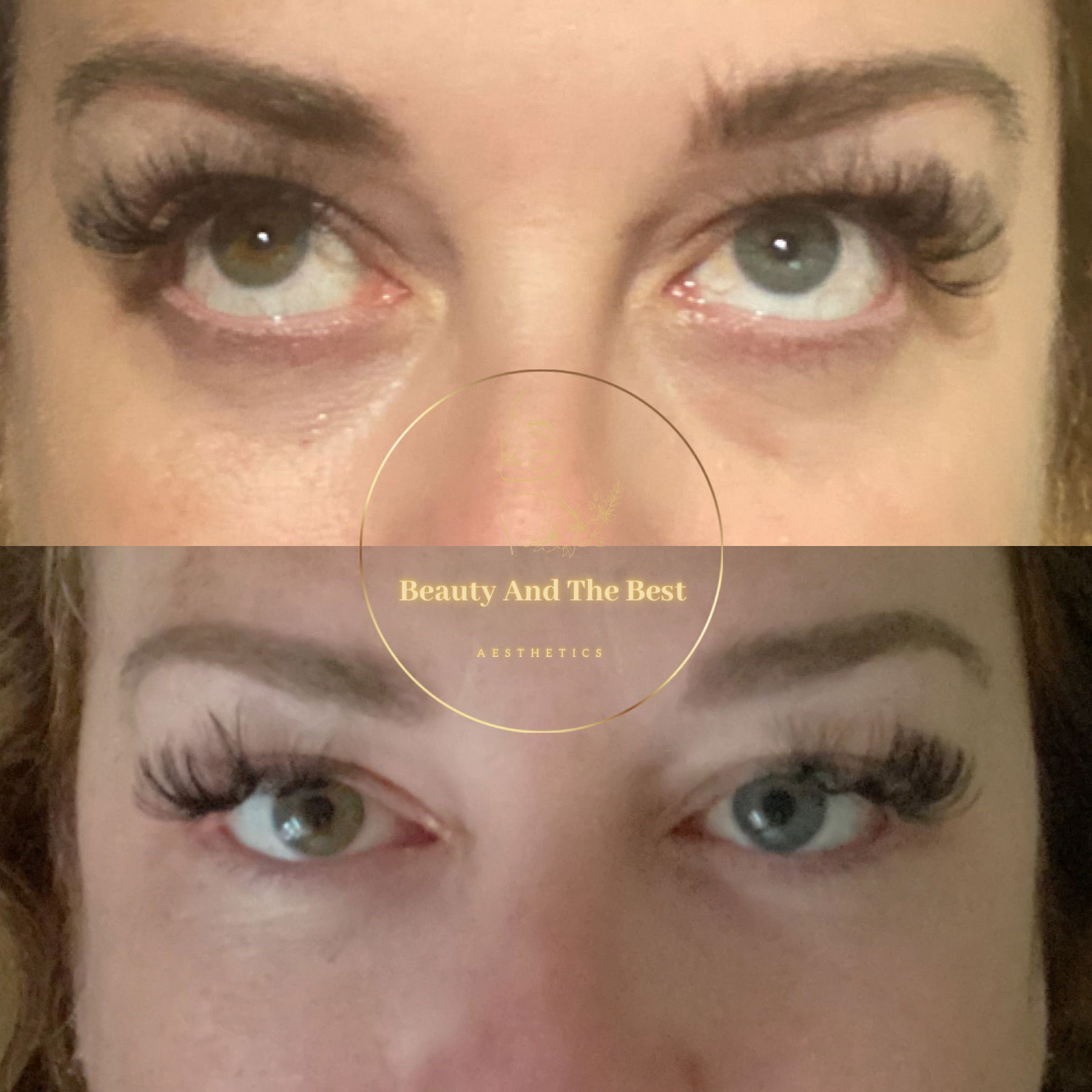 Derma Eye