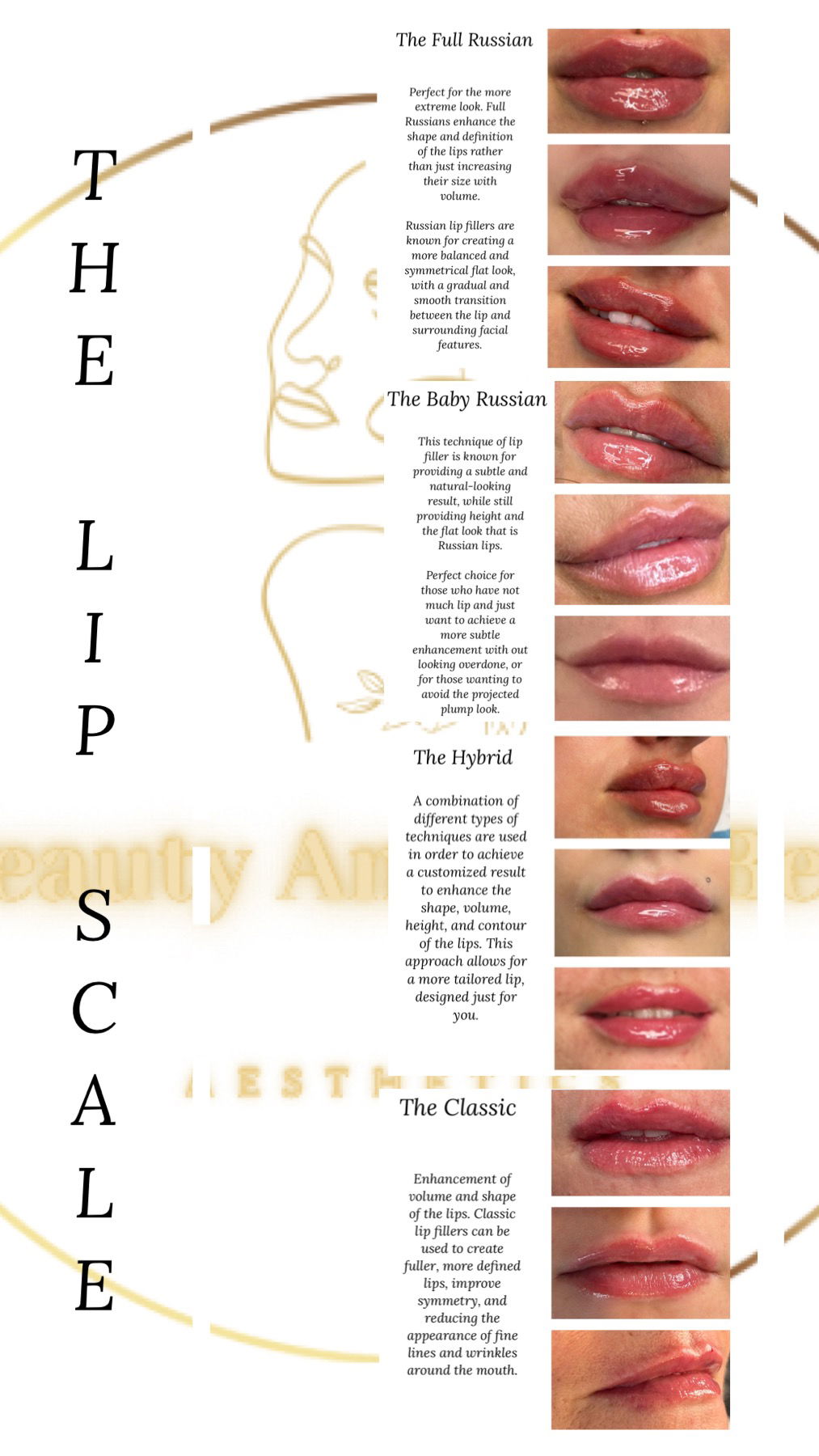 Lip Scale