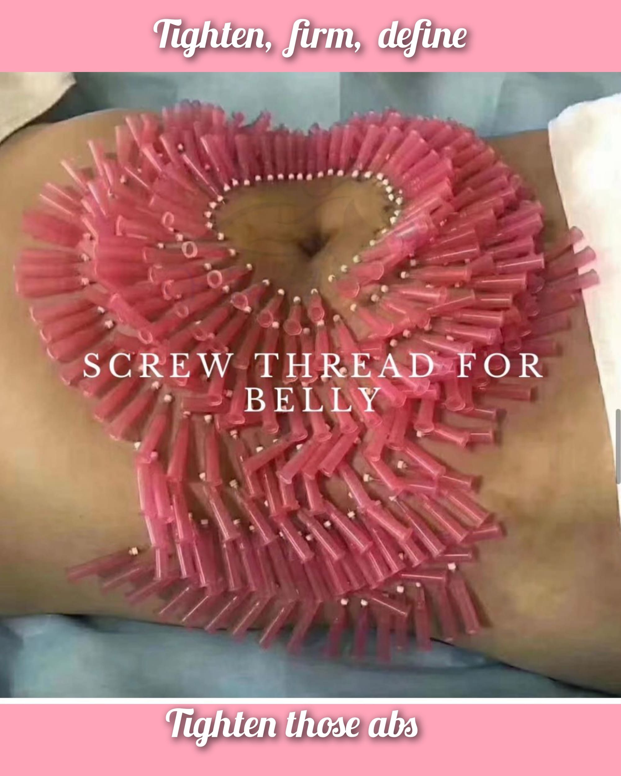 Pdo Smooth and screw threads