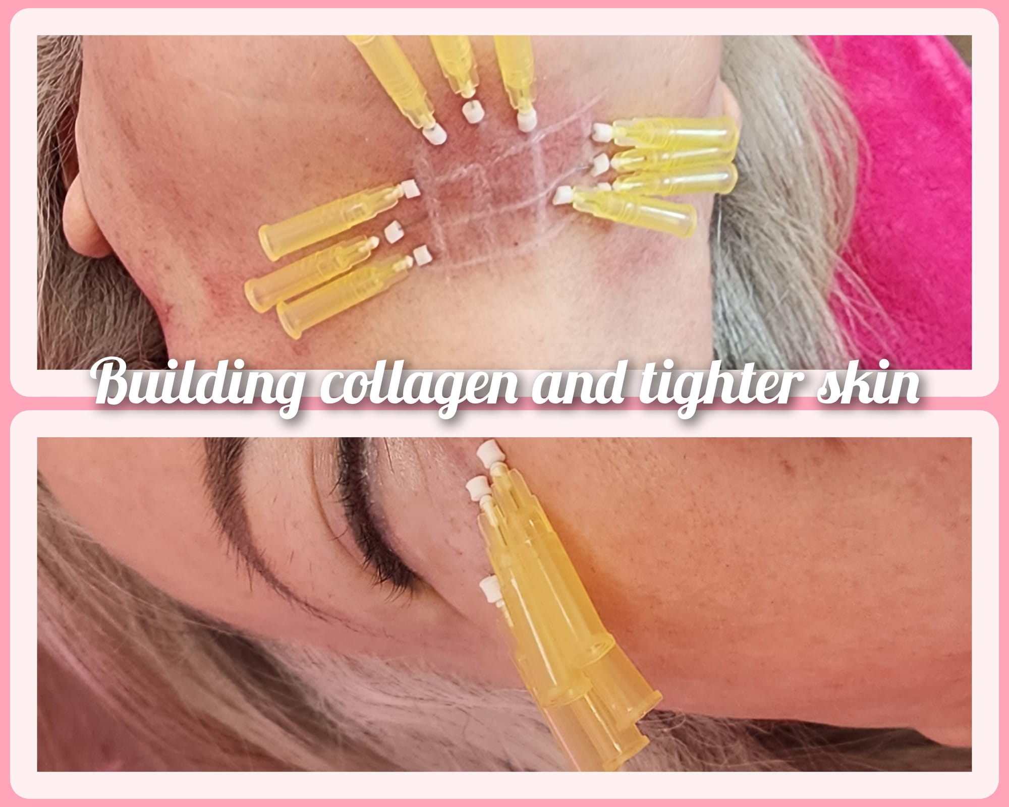 Pdo Smooth and screw threads