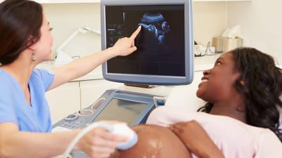 Things To Consider When Looking For An OBGYN