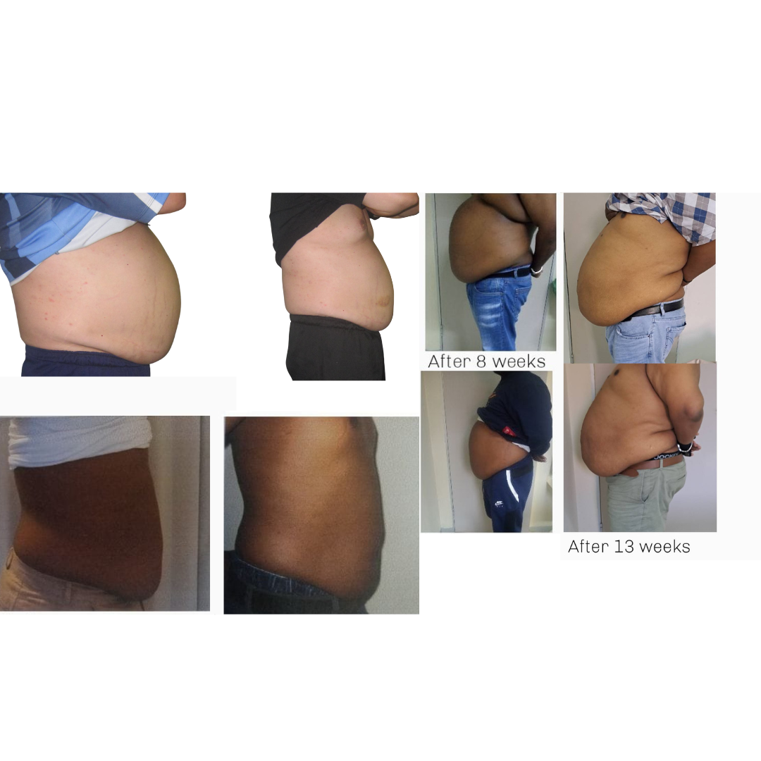 Men Tummy Reduction 