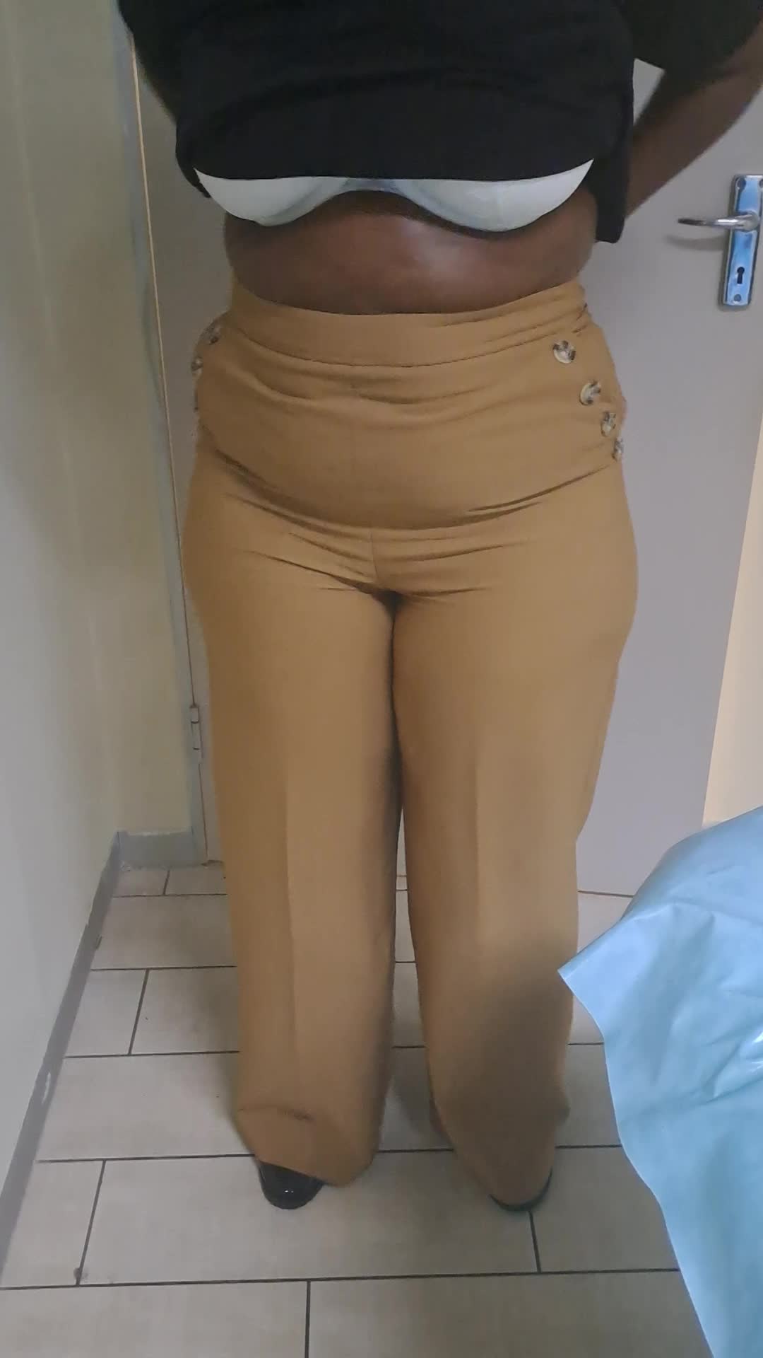 AFTER 1 LIPODISSOLVE EXCLUSIVE TREATMENT