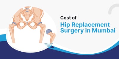 Cost of Hip Replacement Surgery in Mumbai
