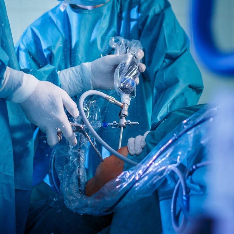 Knee Replacement Surgery: