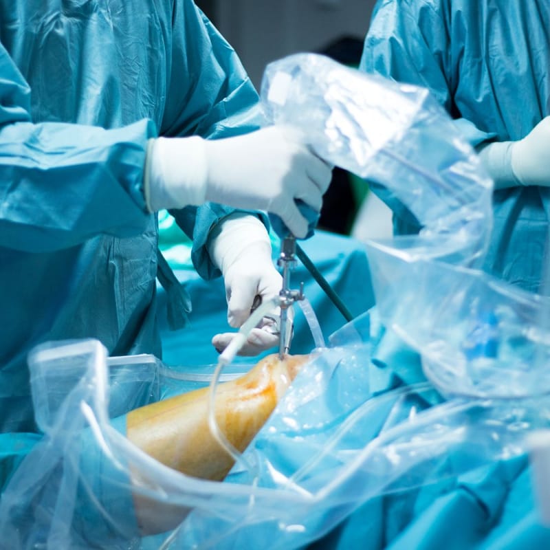 Robotic Knee Replacement Surgery