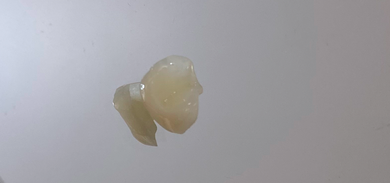DENTÍSTICA RESTAURADORA