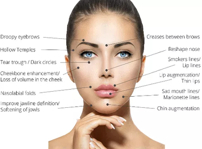 What is a liquid face-lift or Dermal Filler?