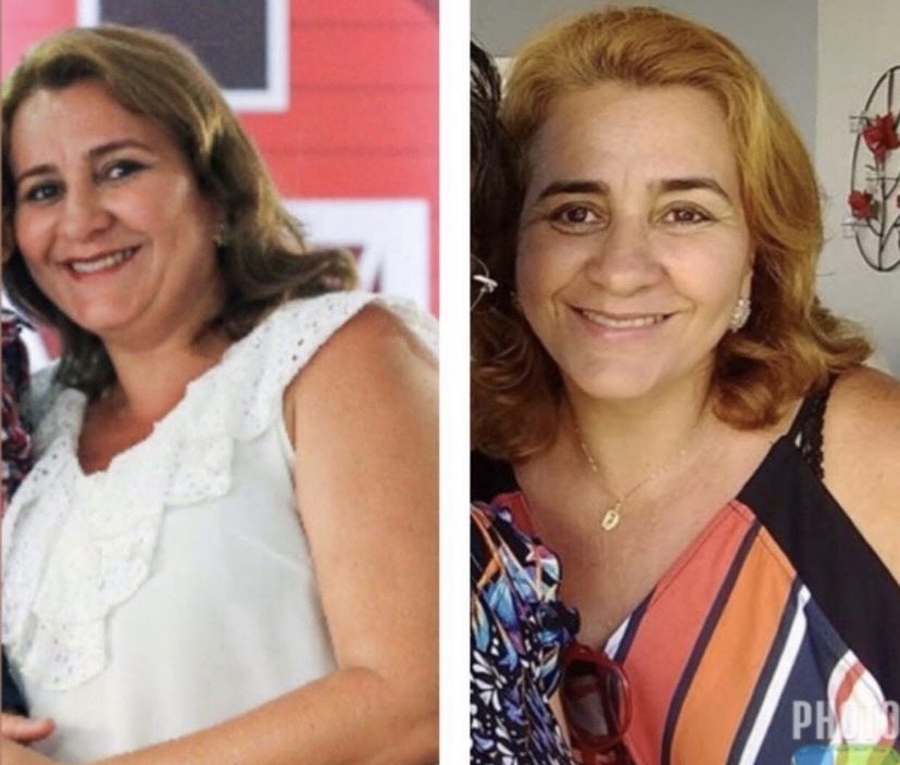 Mudança no shape