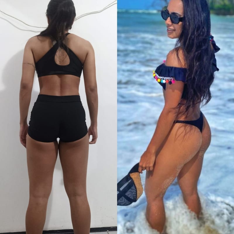 Antes e depois