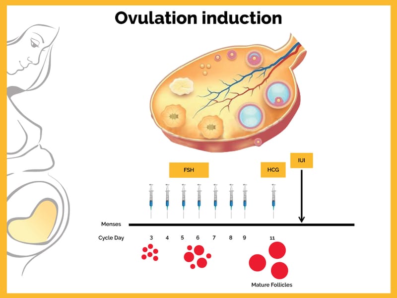 Ovulation-Induction