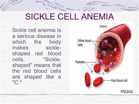 Sickle cell anemia and Thalassemia